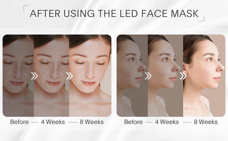 Windaily LED Face Mask with 7 Light Modes – Wireless USB Charging Beauty Therapy