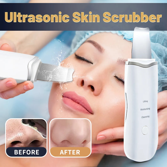 MERALL Ultrasonic Skin Scrubber – EMS Ion Deep Pore Facial Cleaner