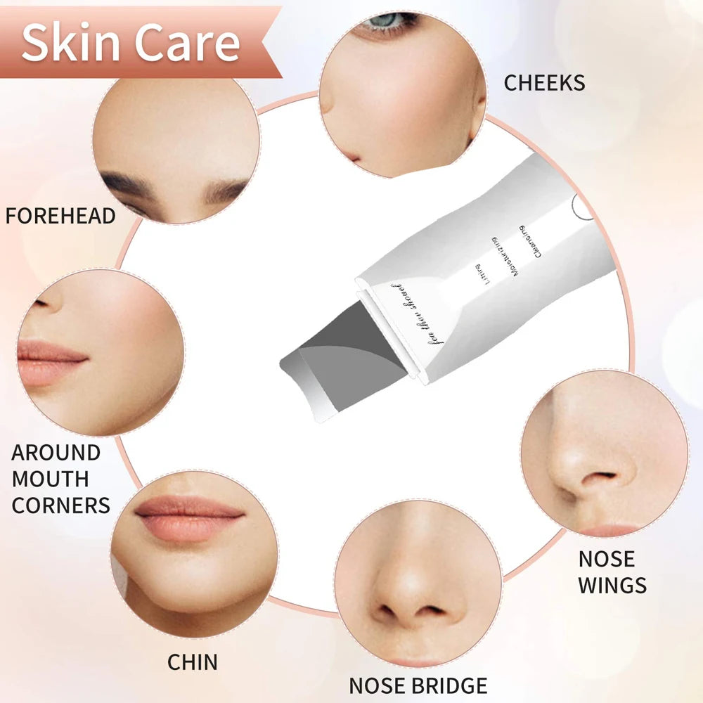 Voguish Ultrasonic Skin Scrubber – Vibration Facial Spatula Blackhead Remover