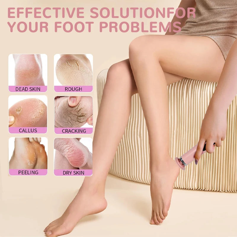 Electric Foot Callus Remover – 6-Speed Rechargeable Foot Grinder with LCD & Sandpaper Set