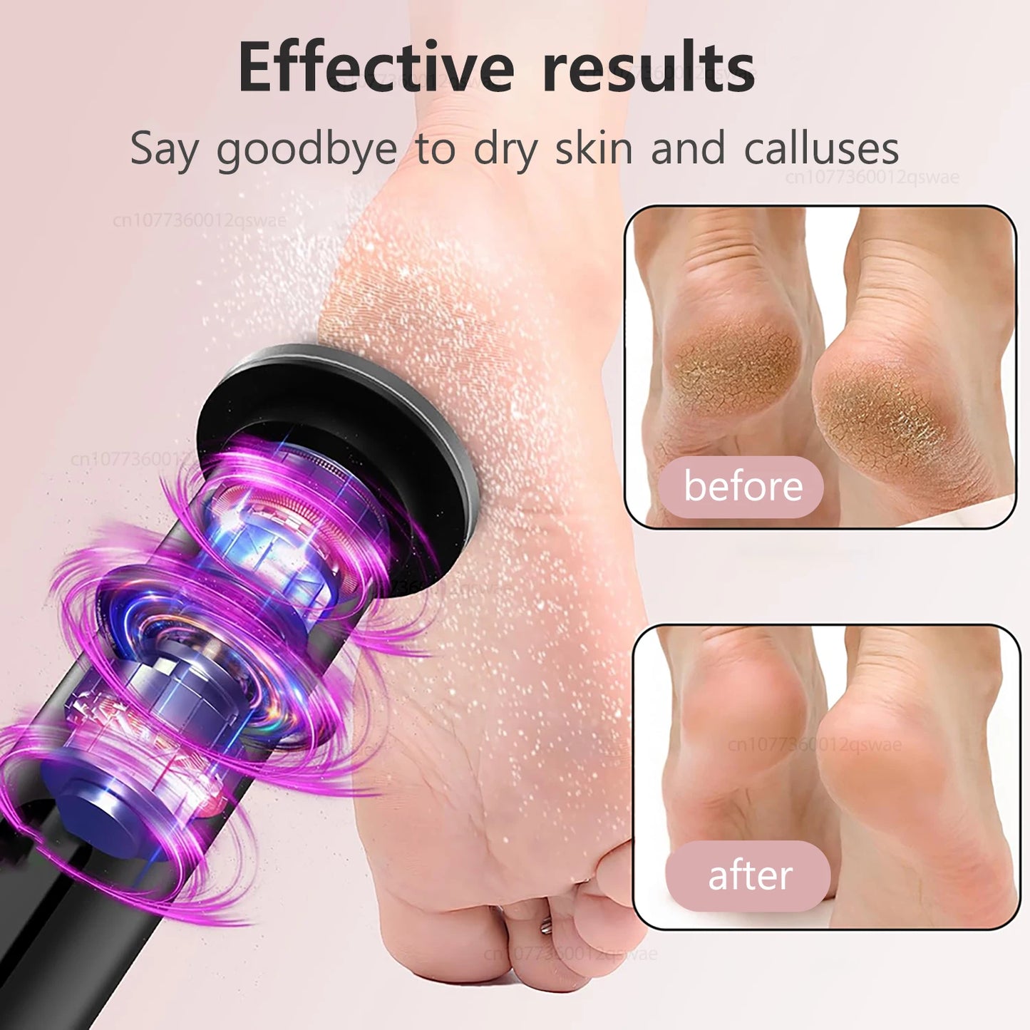 XMSJ 2-in-1 Electric Foot Callus Remover – Rechargeable Foot File & Nail Grinder with 9 Speeds