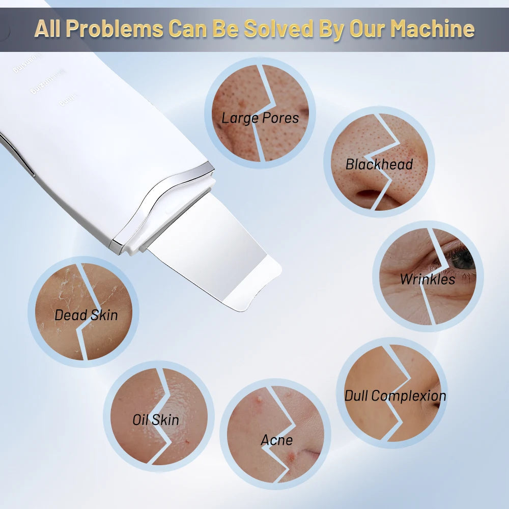 MERALL Ultrasonic Skin Scrubber – EMS Ion Deep Pore Facial Cleaner