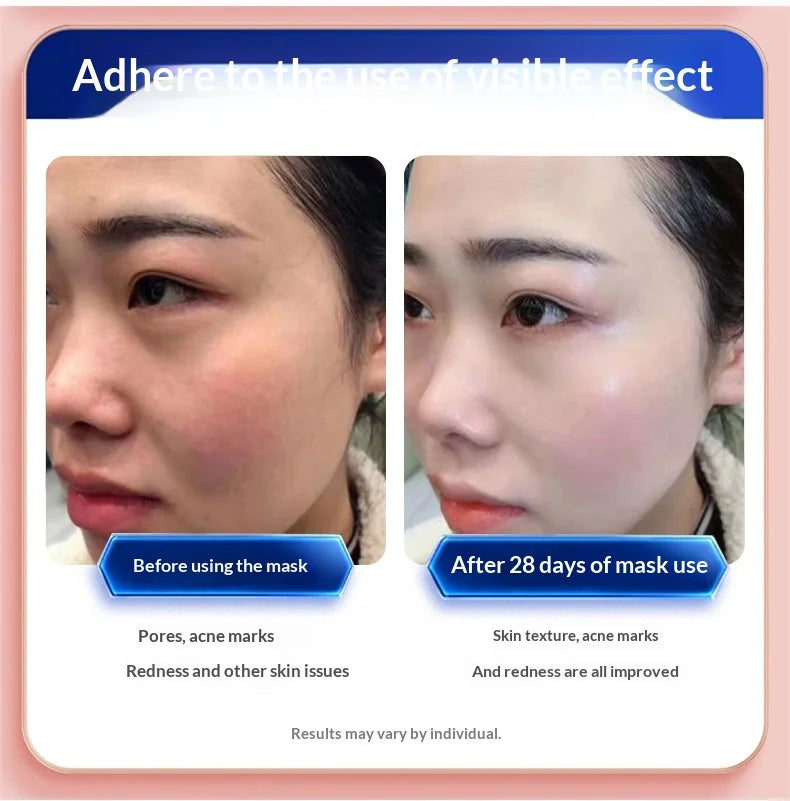 7-Color LED Light Therapy Face Mask – Lifting, Whitening & Anti-Wrinkle Care