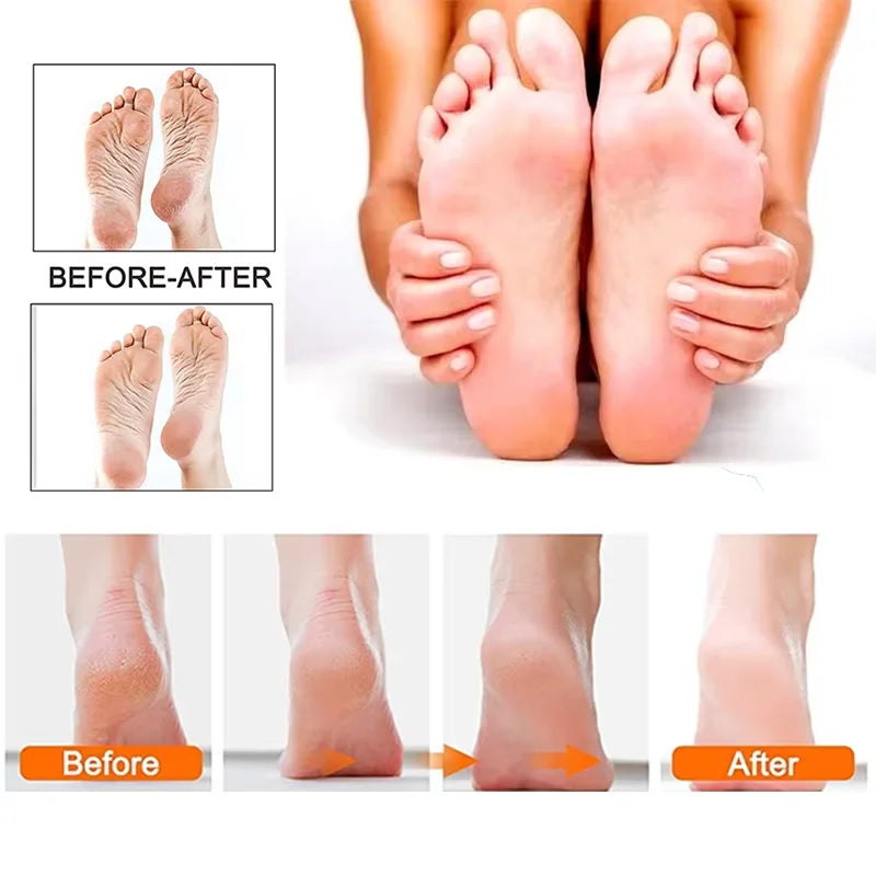 RESUXI Electric Foot Callus Remover – Portable Rechargeable Pedicure Tool (Model 265S)