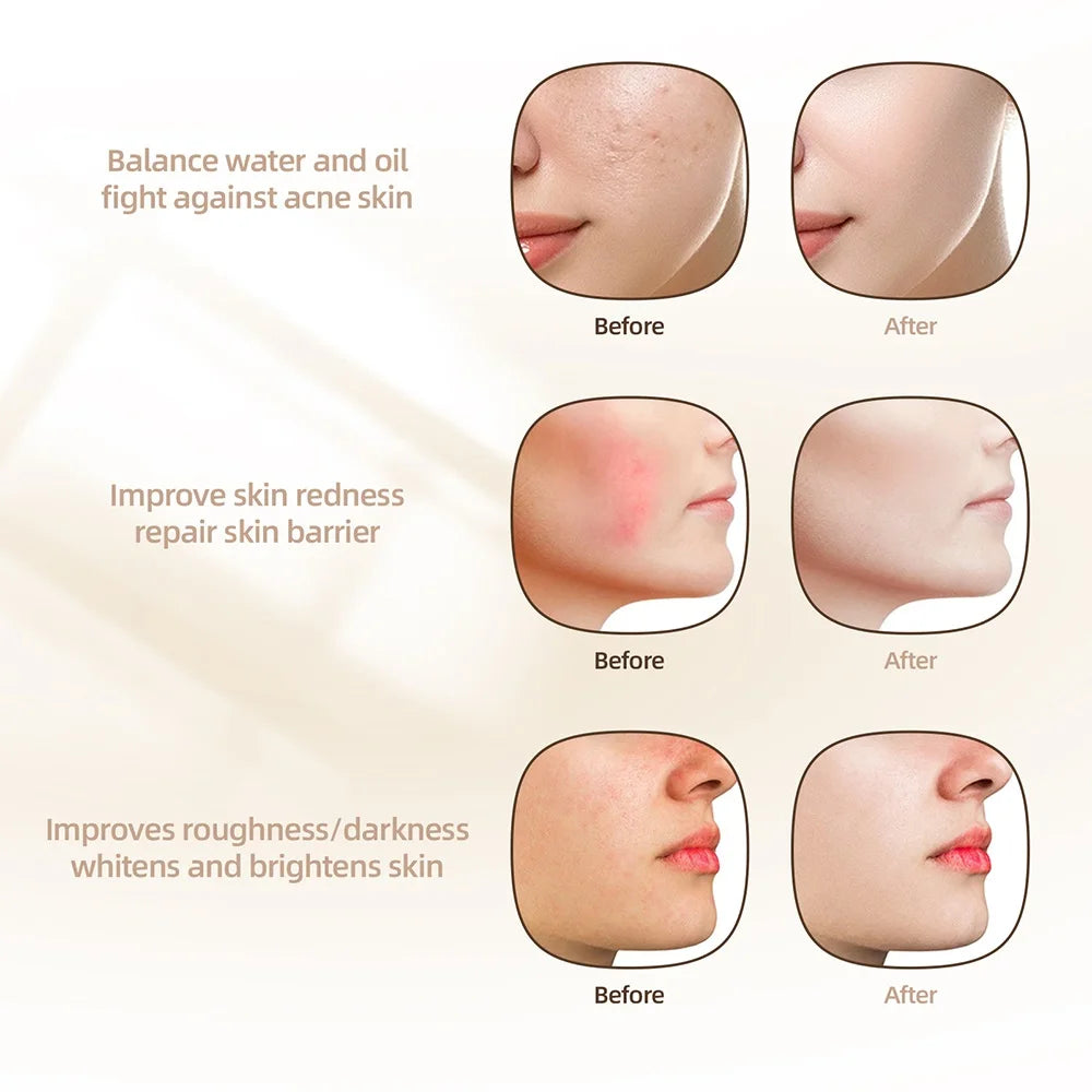 ForeverLily 7-Color Silicone LED Facial Mask – USB Rechargeable Skincare Beauty Device (No Box)