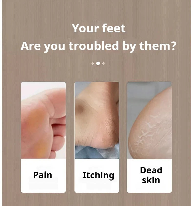 NSOUR Professional Electric Foot Callus Remover – Long Handle, Waterproof, 4 Heads