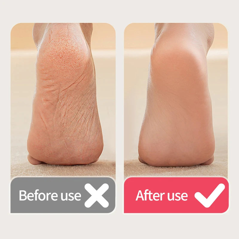 DUTRIEUX Automatic Electric Nail Trimmer – Battery Powered Nail Care Device