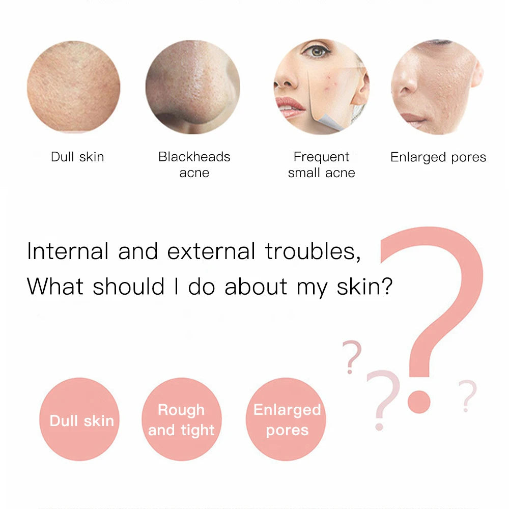 MERALL Ultrasonic Skin Scrubber – EMS Ion Deep Pore Facial Cleaner