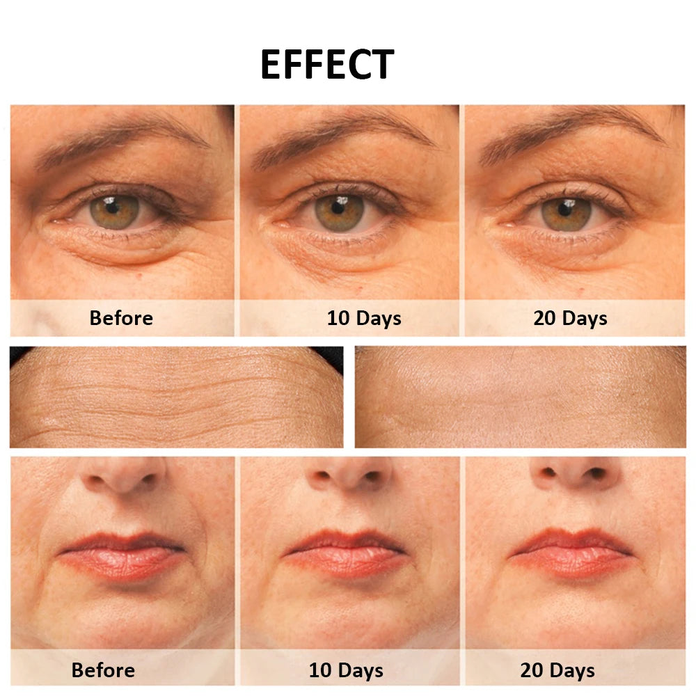 Peicon M80B Radiofrequency Face Massager – Skin Rejuvenation & Firming Tool