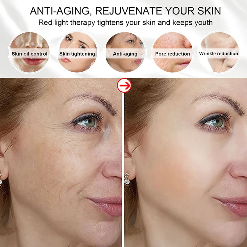 Windaily LED Face Mask with 7 Light Modes – Wireless USB Charging Beauty Therapy