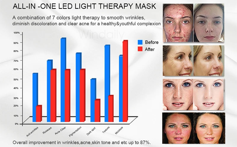 Windaily LED Face Mask with 7 Light Modes – Wireless USB Charging Beauty Therapy