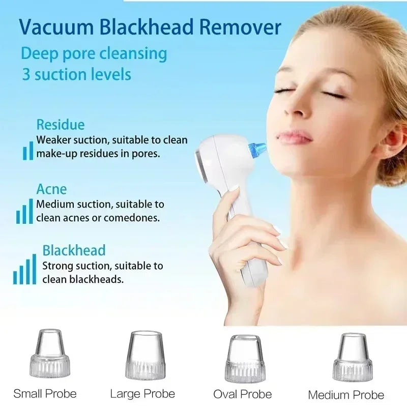 KEMOKO 2-in-1 Blackhead Remover & Facial Cleansing Brush – USB Rechargeable IPX7