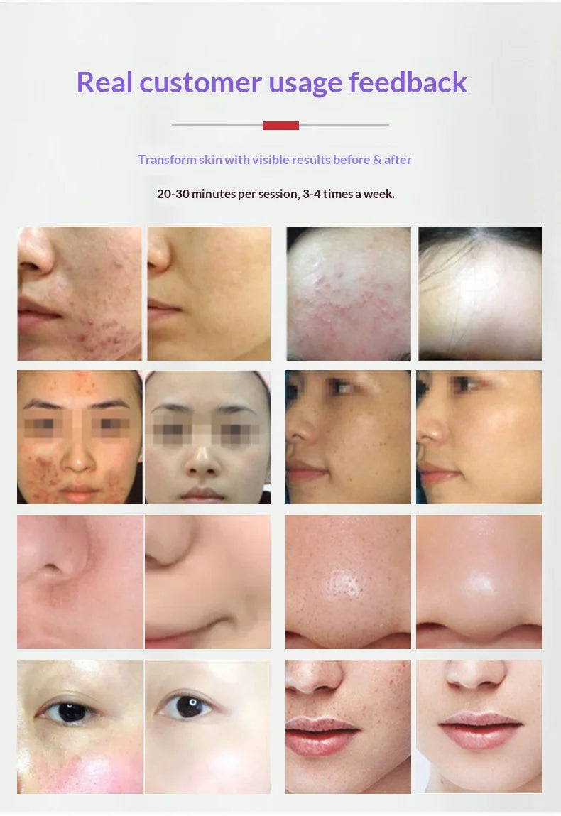 7-Color LED Light Therapy Face Mask – Lifting, Whitening & Anti-Wrinkle Care