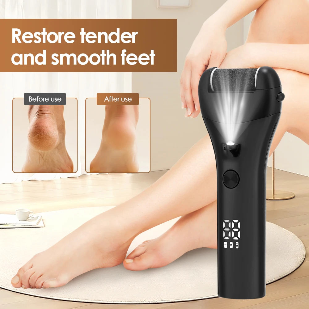 AFDEAL Rechargeable Electric Foot Callus Remover – Professional Pedicure Grinder (Standard / Simple)