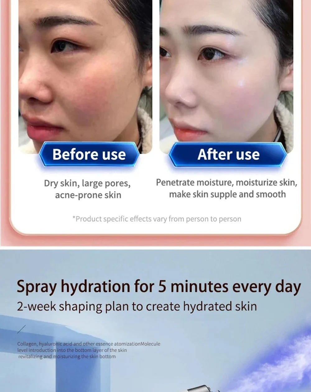 Vilnason ZYP-002 Hot & Cold Facial Steamer – Blue Light Nano Mist Oxygen Injector