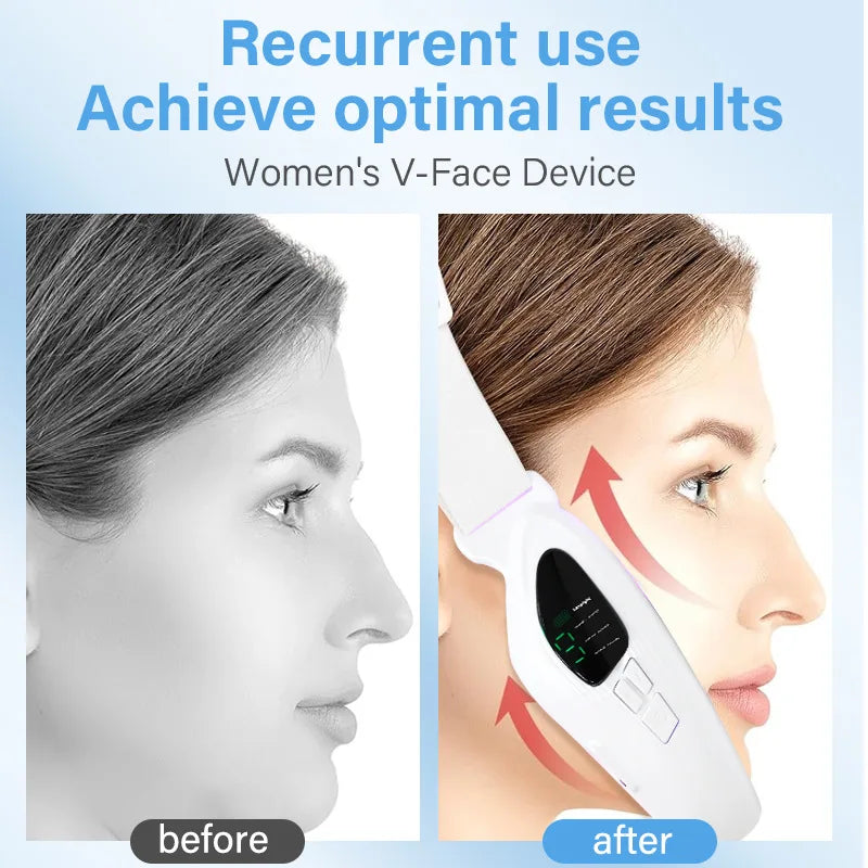 MERALL V Face Facial Lifting Device – Electric Chin & Jawline Sculpting Massager