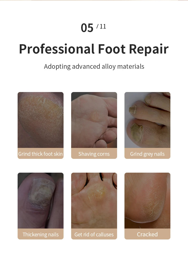 YD Rechargeable Electric Foot File – Portable Callus & Heel Grinder Pedicure Tool