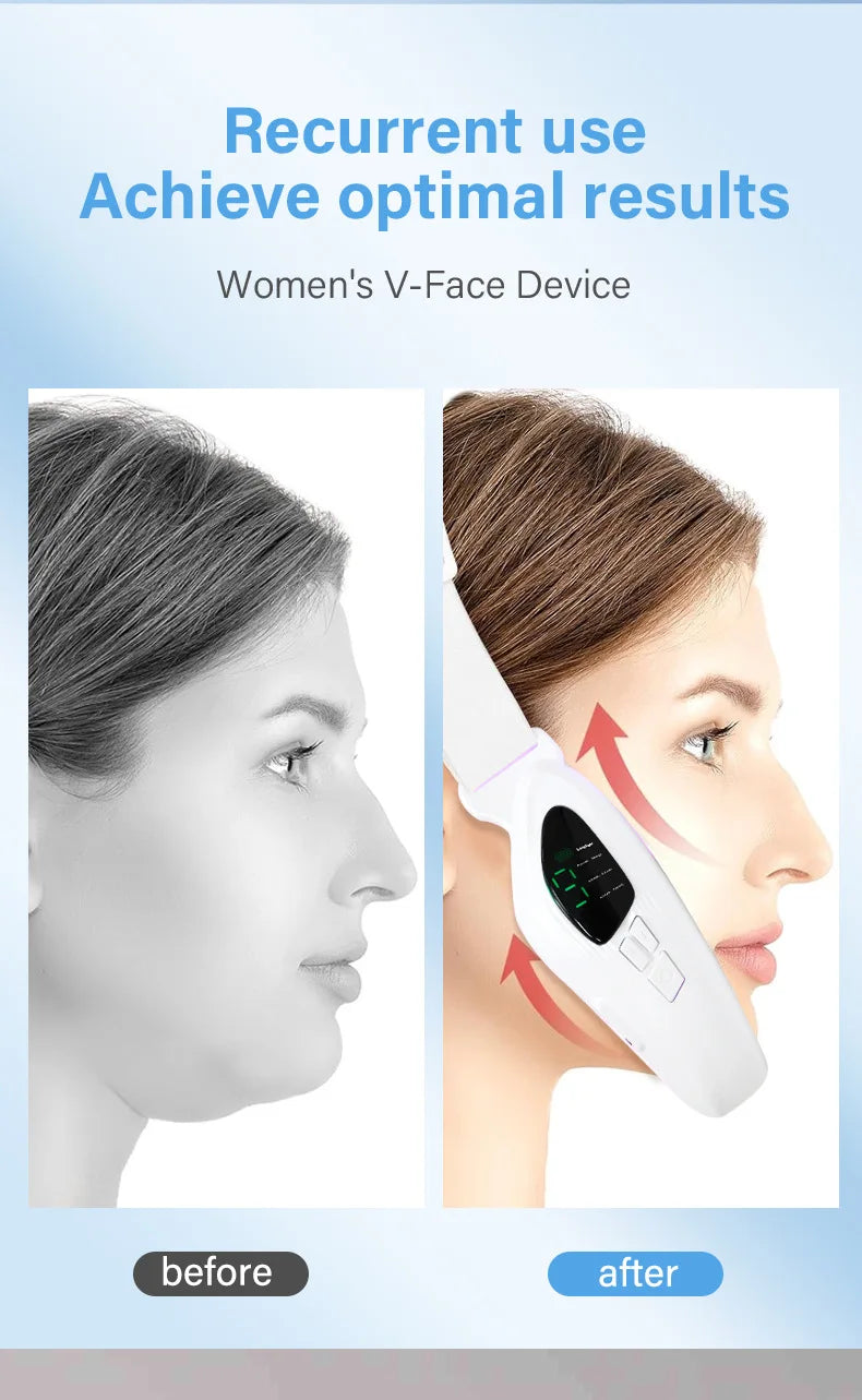 MERALL V Face Facial Lifting Device – Electric Chin & Jawline Sculpting Massager
