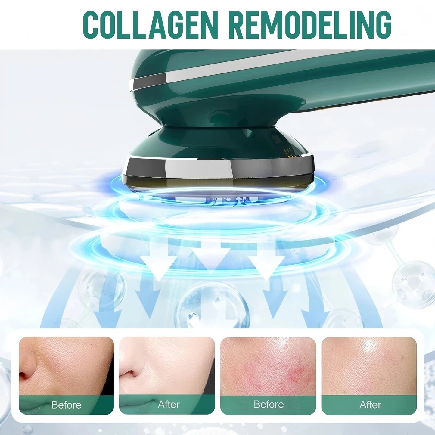 VIMYSHOW EMS Facial Beauty Device ES-1091 – RF LED Microcurrent Skin Tightening