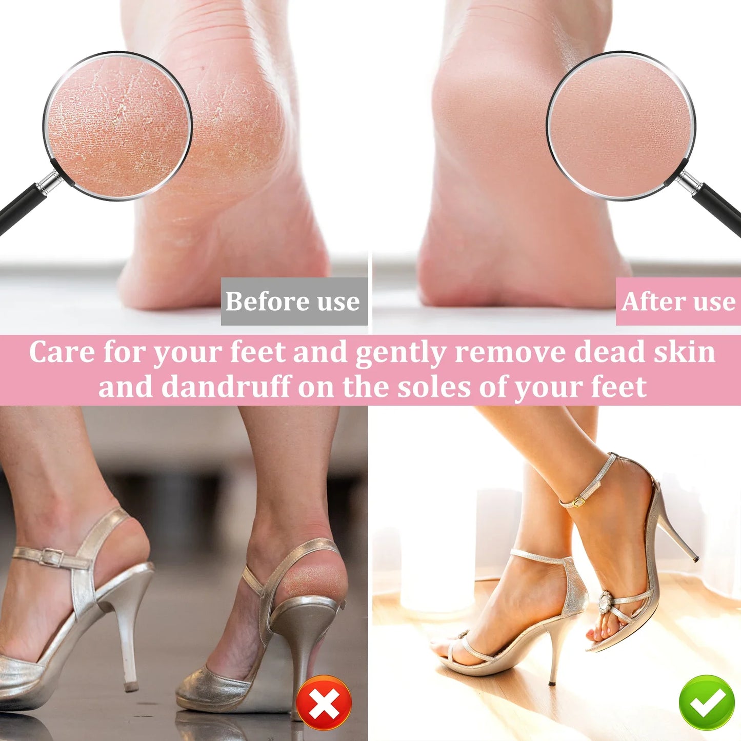 Electric Foot Callus Remover – Professional Aluminum Pedicure Grinder with Adjustable Speed