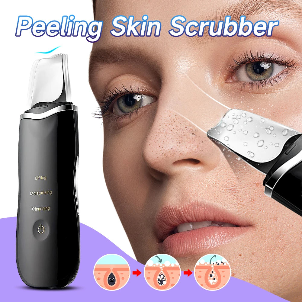 Voguish Ultrasonic Skin Scrubber – Vibration Facial Spatula Blackhead Remover